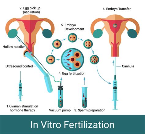 ivf in georgia.